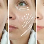 Massage Miracle Face lymphatique pour lifting naturel du visage