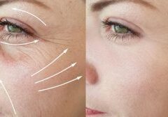 Kobido Massage du Visage Rajeunissant